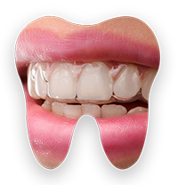 a tooth icon showing a pair of teeth wearing an invisalign
