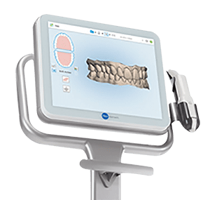 itero scanner displaying the scanned view of the teeth